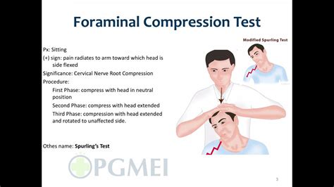 jackson compression test vs spurling& 39|positive spurling test results.